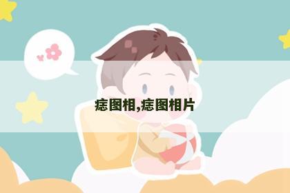 痣图相,痣图相片