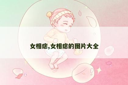 女相痣,女相痣的图片大全