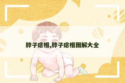 脖子痣相,脖子痣相图解大全